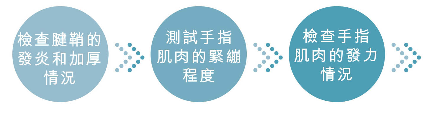 彈弓指 全面治療評估流程